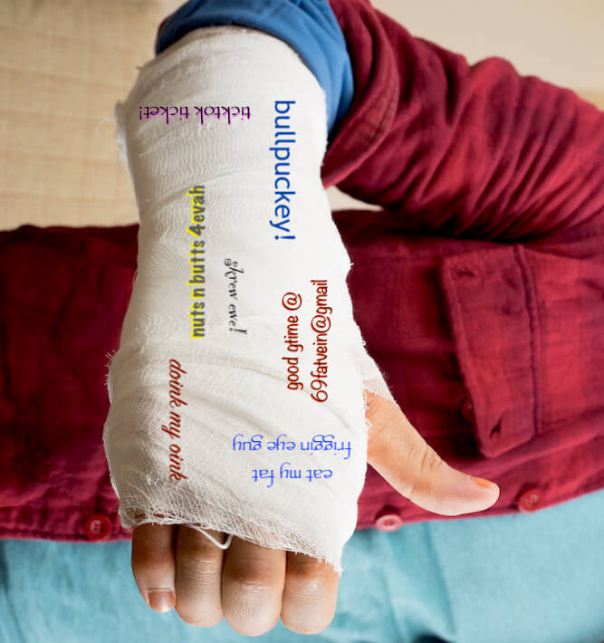Red shirt and white cast with various epithets penned by 'friends' and 'frenemies'.